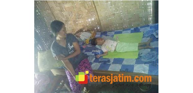 Derita Tumor Kepala, Balita di Wates Blitar Butuh Uluran Tangan Pemerintah Derita Tumor Kepala, Balita di Wates Blitar Butuh Uluran Tangan Pemerintah
