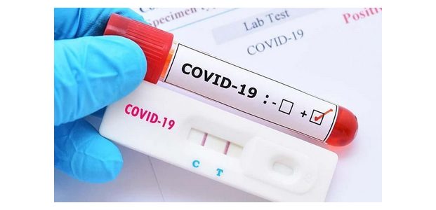 Duh, 3 Petugas Puskesmas di Bojonegoro Positif Covid-19 Duh, 3 Petugas Puskesmas di Bojonegoro Positif Covid-19