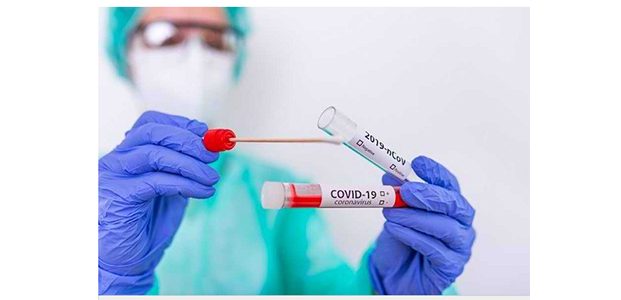 Biaya Rapid Test Antigen-Swab di Jawa Rp 250 Ribu, Luar Jawa Rp 275 Ribu Biaya Rapid Test Antigen-Swab di Jawa Rp 250 Ribu, Luar Jawa Rp 275 Ribu