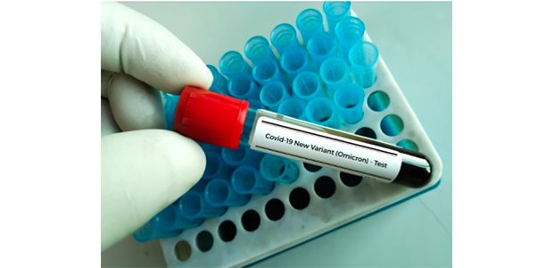 Ada 1 Kasus Omicron Transmisi Lokal Terdeteksi, Positif Omicron di Indonesia Jadi 47 Ada 1 Kasus Omicron Transmisi Lokal Terdeteksi, Positif Omicron di Indonesia Jadi 47