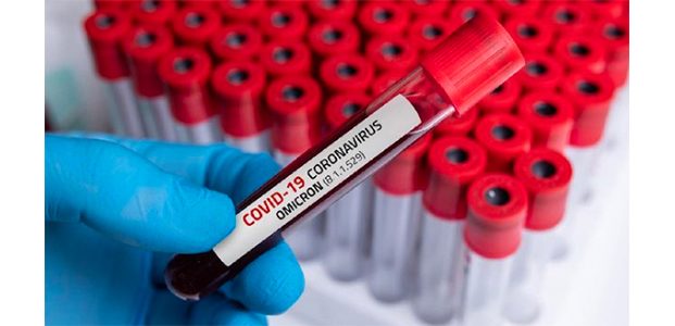 Hingga Hari Ini, Jumlah Kasus Omicron di Indonesia Bertambah Jadi 152 Hingga Hari Ini, Jumlah Kasus Omicron di Indonesia Bertambah Jadi 152