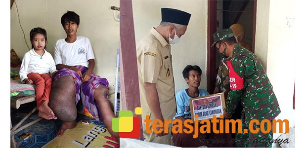 Anggota Koramil Beri Bantuan ke Penderita Kaki Gajah di Turi Lamongan Anggota Koramil Beri Bantuan ke Penderita Kaki Gajah di Turi Lamongan