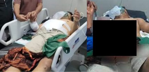 Carok Satu Lawan Satu, Pak Kades dan Pak Kasun di Jatiroto Lumajang Terluka Parah
