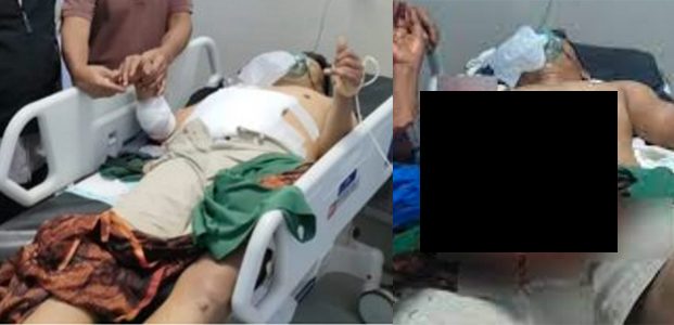 Carok Satu Lawan Satu, Pak Kades dan Pak Kasun di Jatiroto Lumajang Terluka Parah Carok Satu Lawan Satu, Pak Kades dan Pak Kasun di Jatiroto Lumajang Terluka Parah
