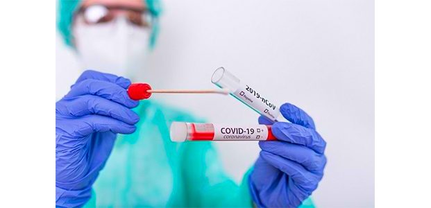 Biaya Rapid Test Antigen di Kabupaten Malang Ditetapkan Rp50 Ribu Biaya Rapid Test Antigen di Kabupaten Malang Ditetapkan Rp50 Ribu