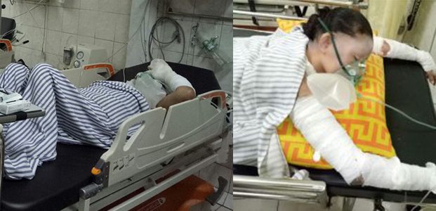 Masak Bakso Gas Elpiji Bocor, 2 Wanita di Jombang Alami Luka Bakar Parah Masak Bakso Gas Elpiji Bocor, 2 Wanita di Jombang Alami Luka Bakar Parah