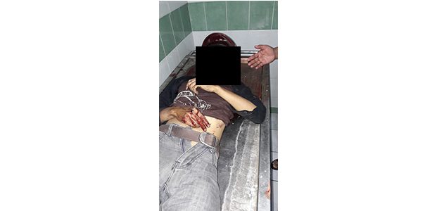 Panik Dikejar Warga, Pelaku Jambret di Gresik Tewas Tabrakan Panik Dikejar Warga, Pelaku Jambret di Gresik Tewas Tabrakan