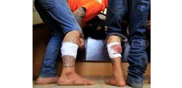 Polres Bangkalan Tembak Dua Begal Jalanan Polres Bangkalan Tembak Dua Begal Jalanan