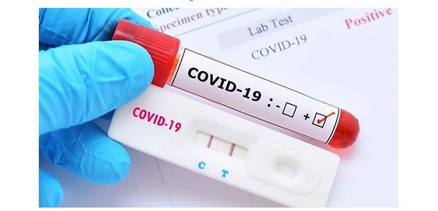 Satu Bakal Calon Peserta Pilkada Kota Surabaya Positif Covid-19 Satu Bakal Calon Peserta Pilkada Kota Surabaya Positif Covid-19