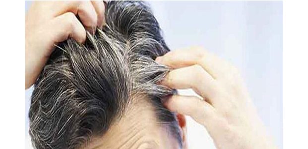 Rambut Ubanan di Usia Muda? Mungkin ini Penyebabnya Rambut Ubanan di Usia Muda? Mungkin ini Penyebabnya